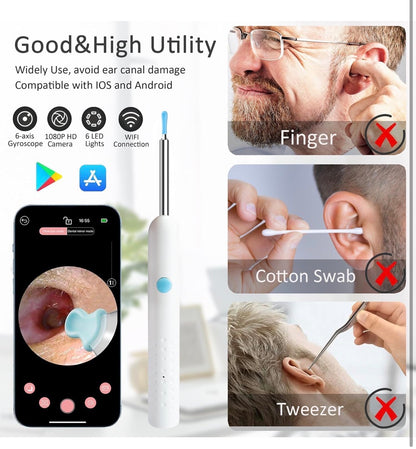 Smart Visual Ear Cleaner with Camera – Wireless Ear Wax Removal Tool Kit